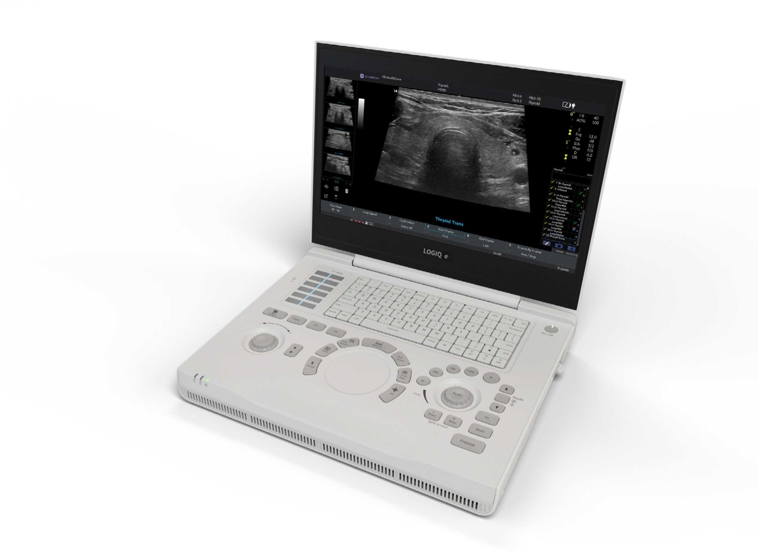 Ge Logiq R R9 LOGIQ R9 - Ecografia